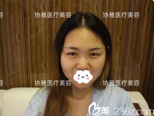 術(shù)前醫(yī)生面診設(shè)計(jì)