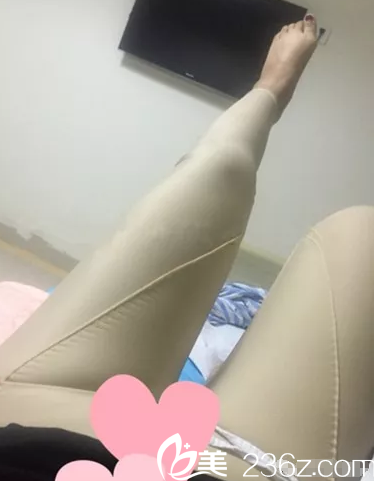 大腿吸脂術(shù)后穿著塑身衣