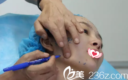 康寶峰醫(yī)生為我注射前畫線 康寶峰醫(yī)生為我注射前畫線