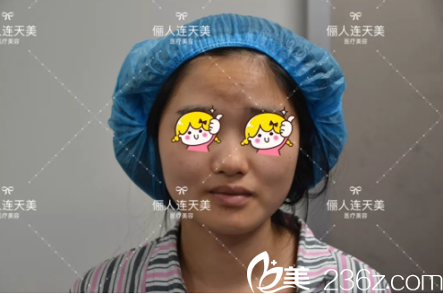 術(shù)前鼻子塌問(wèn)題較多 術(shù)前鼻子塌問(wèn)題較多