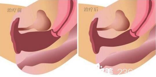 私密整形治療前后
