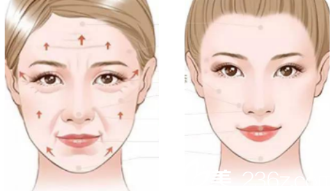 于曉春面部微雕示意圖效果展示 于曉春面部微雕示意圖效果展示