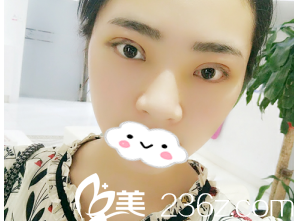 術(shù)后第三天