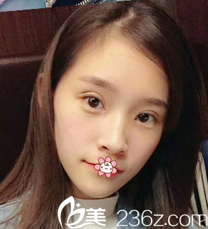 李富強(qiáng)院長(zhǎng)給我做完手術(shù)第四天