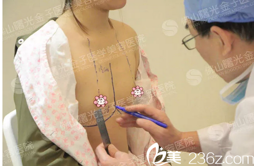 佛山曙光金子何宜新院長(zhǎng)隆胸術(shù)前劃線設(shè)計(jì)中