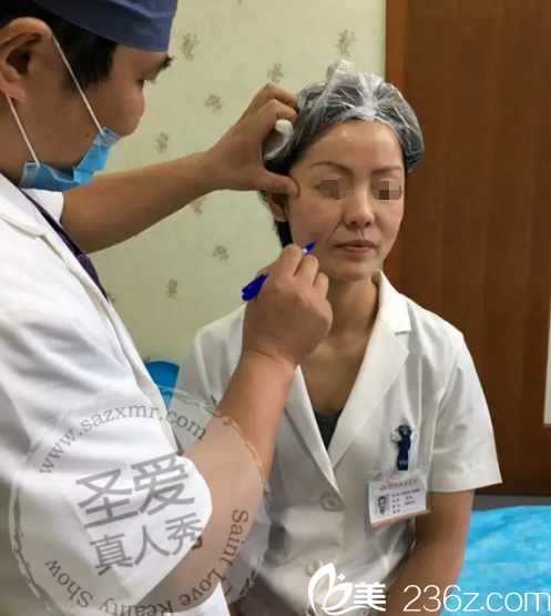 埋線提升術(shù)前面診設(shè)計