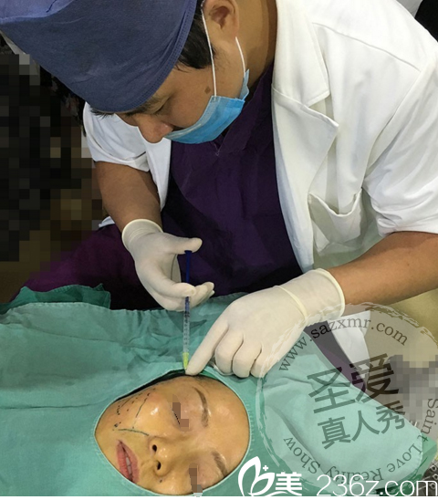 4D精雕塑形面部提升術(shù)前麻醉