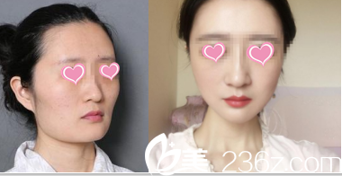 北京圣嘉榮黃大勇改臉型<span style=