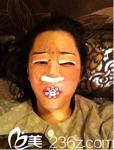 金智勛院長給我做完手術(shù)當(dāng)天