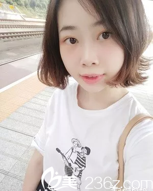 不知不覺找深圳健麗醫(yī)美陳雪濤做雙眼皮祛眼袋三周效果分享 不知不覺找深圳健麗醫(yī)美陳雪濤做雙眼皮祛眼袋三周效果分享