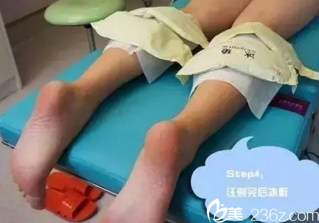 注射完瘦腿之后冰敷 注射完瘦腿之后冰敷