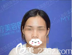 手術(shù)前正面照 手術(shù)前正面照