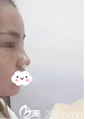 術(shù)后第七天 術(shù)后第七天