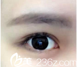 手術(shù)半個月后 手術(shù)半個月后