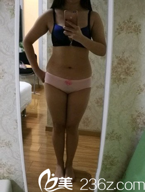 術(shù)前的我 術(shù)前的我