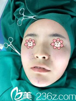 <!--<i data=20240703-sp></i>-->醫(yī)生給我做完手術(shù)當(dāng)天 <!--<i data=20240703-sp></i>-->醫(yī)生給我做完手術(shù)當(dāng)天