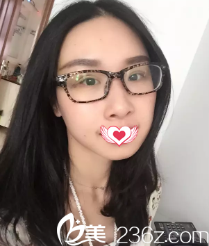 剛做完雙眼皮手術(shù)眼睛腫脹 剛做完雙眼皮手術(shù)眼睛腫脹