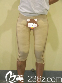 張寶譽醫(yī)生給我做完手術(shù)當天