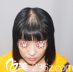 嫌頭發(fā)少我專門做了齊<!--<i data=20240703-sp></i>--> 嫌頭發(fā)少我專門做了齊<!--<i data=20240703-sp></i>-->