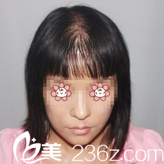 去重慶時光整形醫(yī)院前的我 去重慶時光整形醫(yī)院前的我