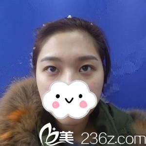 手術(shù)前的我 手術(shù)前的我