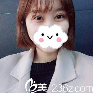 哈爾濱白莉醫(yī)生和王潔醫(yī)生誰割雙眼皮好看？看我在大慶彤名找白莉醫(yī)生做的7mm雙眼皮一個月后的恢復效果