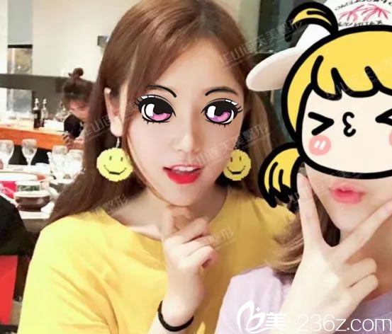 鼻部奧美定取出后15天效果 鼻部奧美定取出后15天效果