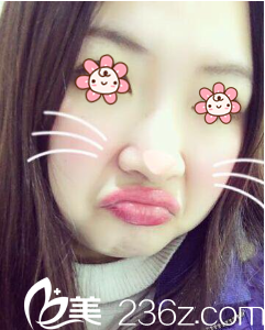 我以前的大鼻子 我以前的大鼻子