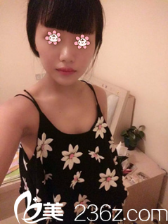 術(shù)前我的胸特別小 術(shù)前我的胸特別小