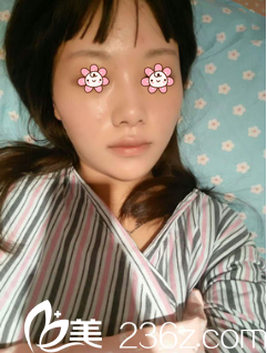 許黎醫(yī)生給我手術(shù)當(dāng)天 許黎醫(yī)生給我手術(shù)當(dāng)天