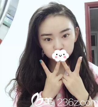 發(fā)際線種植一個月