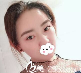 快看找長沙美萊做發(fā)際線種植10個月后，讓她的美變成滿分！