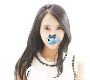 濮陽源美溫賞面部脂肪填充恢復后