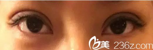 失敗修復(fù)后第三天