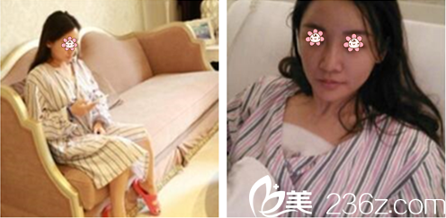 張寶譽(yù)主任給我術(shù)后第三天