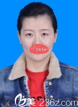 年輕時(shí)單眼皮的樣子 年輕時(shí)單眼皮的樣子