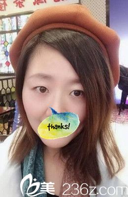 雙眼皮術(shù)前素顏照 雙眼皮術(shù)前素顏照