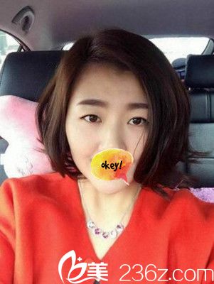 洛陽愛尚做雙眼皮手術(shù)前 洛陽愛尚做雙眼皮手術(shù)前