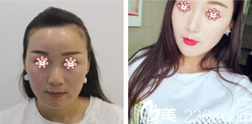 申?yáng)|敏院長(zhǎng)面部輪廓案例