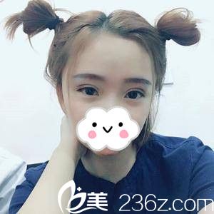 術(shù)后25天