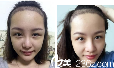 種植后第40天的樣子