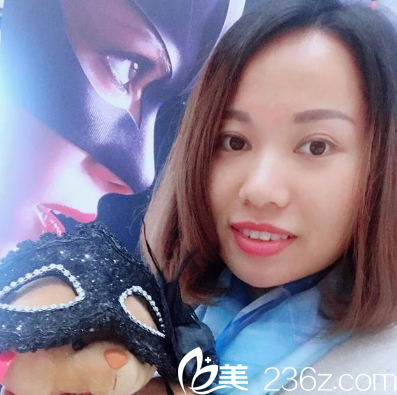 深圳富華醫(yī)療美容醫(yī)院做的雙眼皮兩個月效果圖