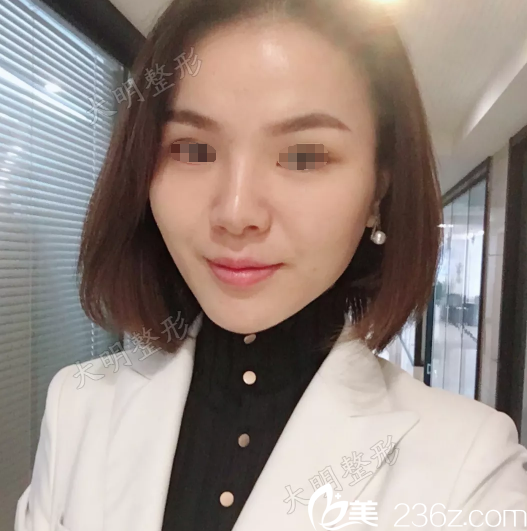 連云港大明整形張培鑒院長分享：3D全面部線雕+下頜緣提升真人案例，抗衰除皺聯(lián)合運用效果更好