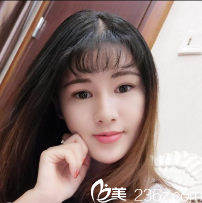 <!--<i data=20240703-sp></i>-->整形醫(yī)院陳瑞紅面部線雕提升兩個(gè)月效果圖 <!--<i data=20240703-sp></i>-->整形醫(yī)院陳瑞紅面部線雕提升兩個(gè)月效果圖