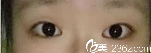 Channel整形醫(yī)院手術前