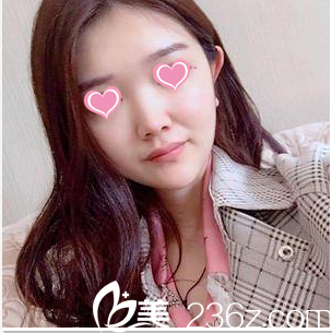 在北京畫美做隆鼻前樣子 在北京畫美做隆鼻前樣子