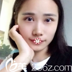 唐明芳主任給我手術(shù)后8天