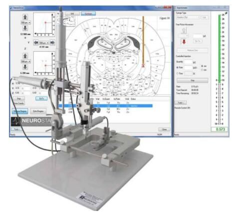 韓國黃金比整形外科3D影像骨定位系統(tǒng) 韓國黃金比整形外科3D影像骨定位系統(tǒng)