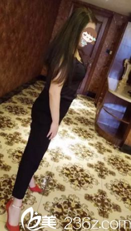 大肚腩怎么減掉 看韓國Channel整形醫(yī)院韓忠熙院長腰腹部吸脂手術案例