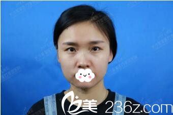 在長沙美萊注射前 在長沙美萊注射前